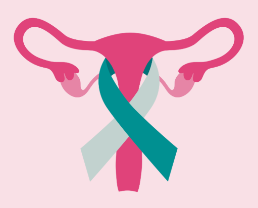 Why There *Still* Isn’t a Routine Screening Exam for Ovarian Cancer